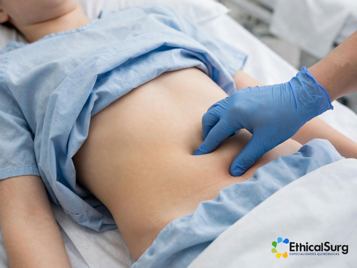 Apendicitis Quito